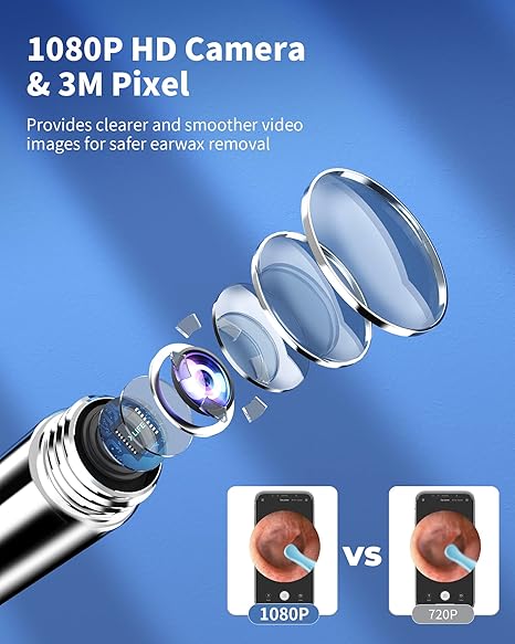 SmartScan Wireless Ear Cleaner with Camera Wireless Otoscope 1080P HD Camera Ear Wax Removal Kit for iPhone iPad Android 360 Wide Angle Lens